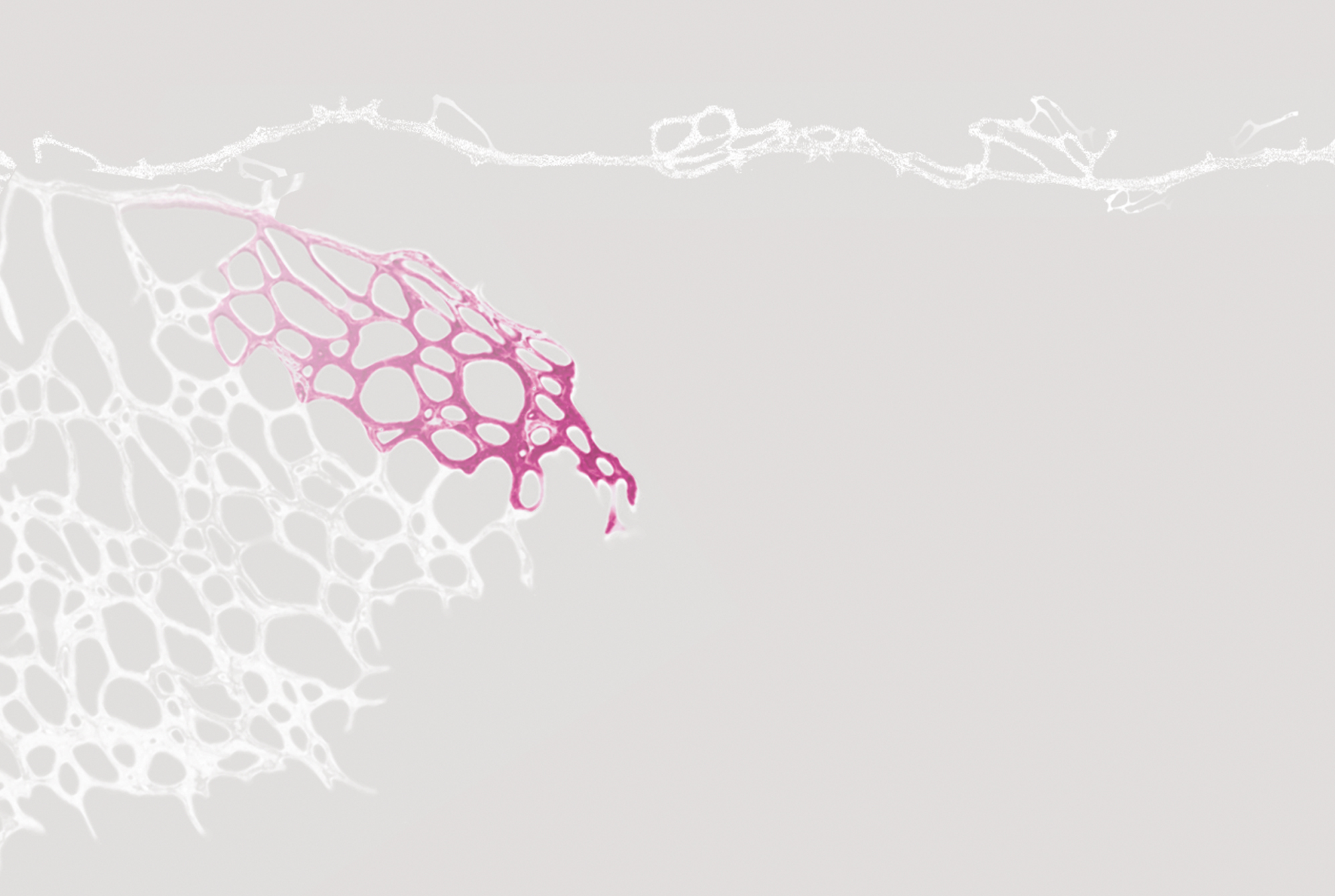 Angiogenesis & Metabolism Laboratory