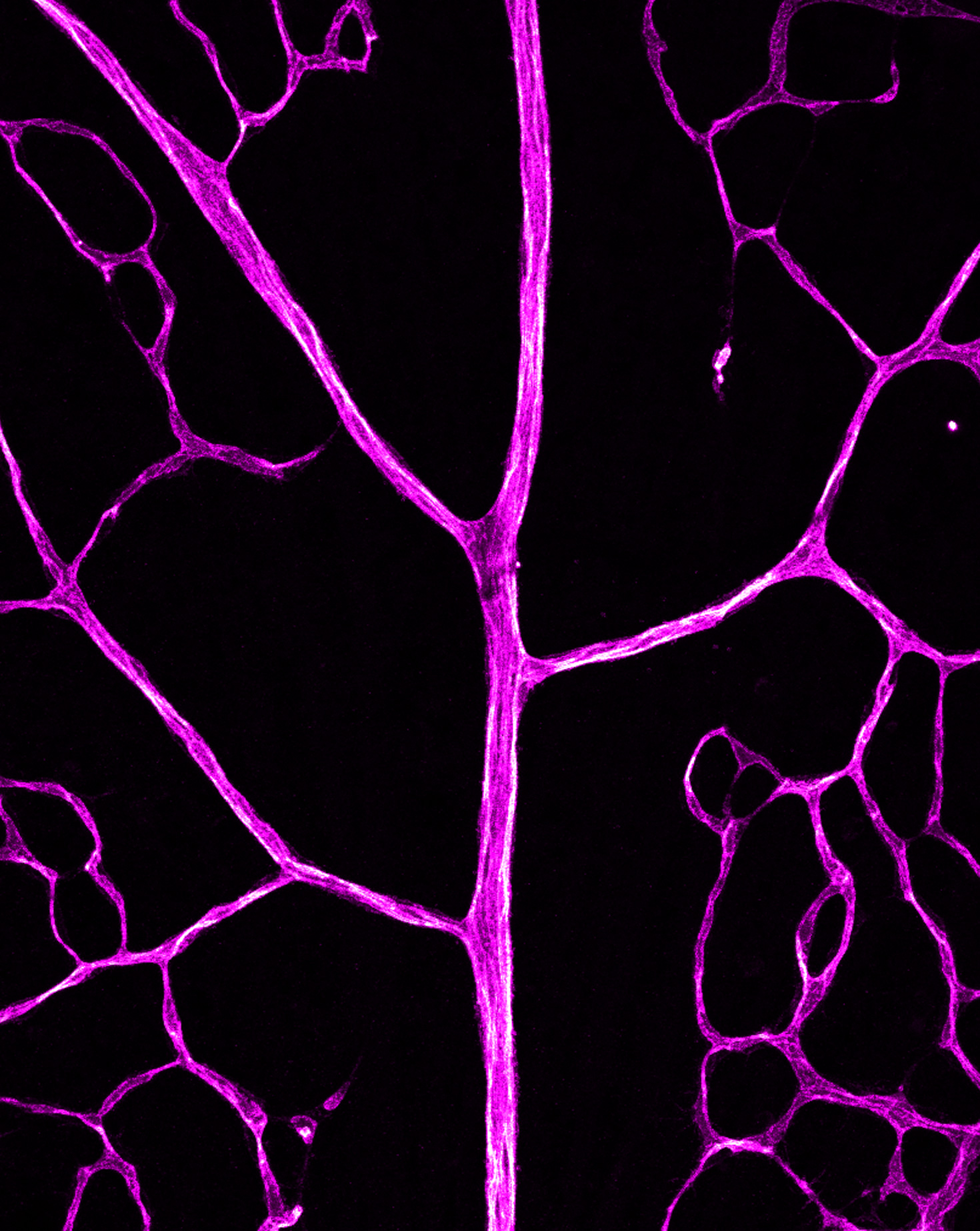 Angiogenesis & Metabolism Laboratory